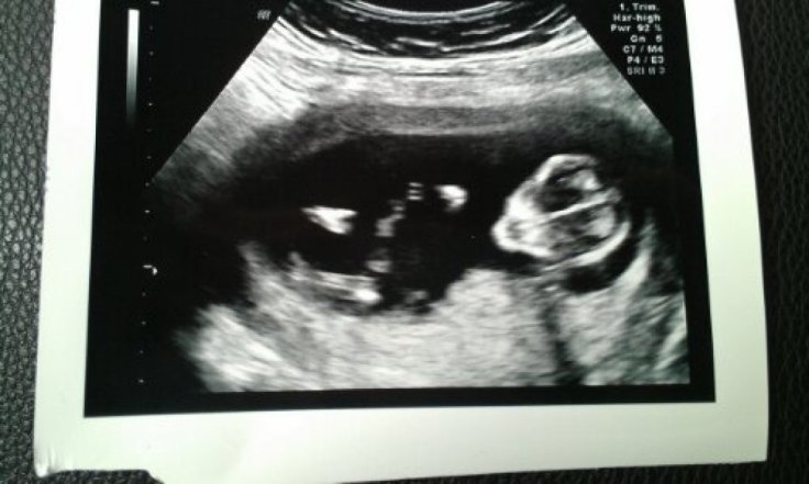 IMAG4554_1.jpg image